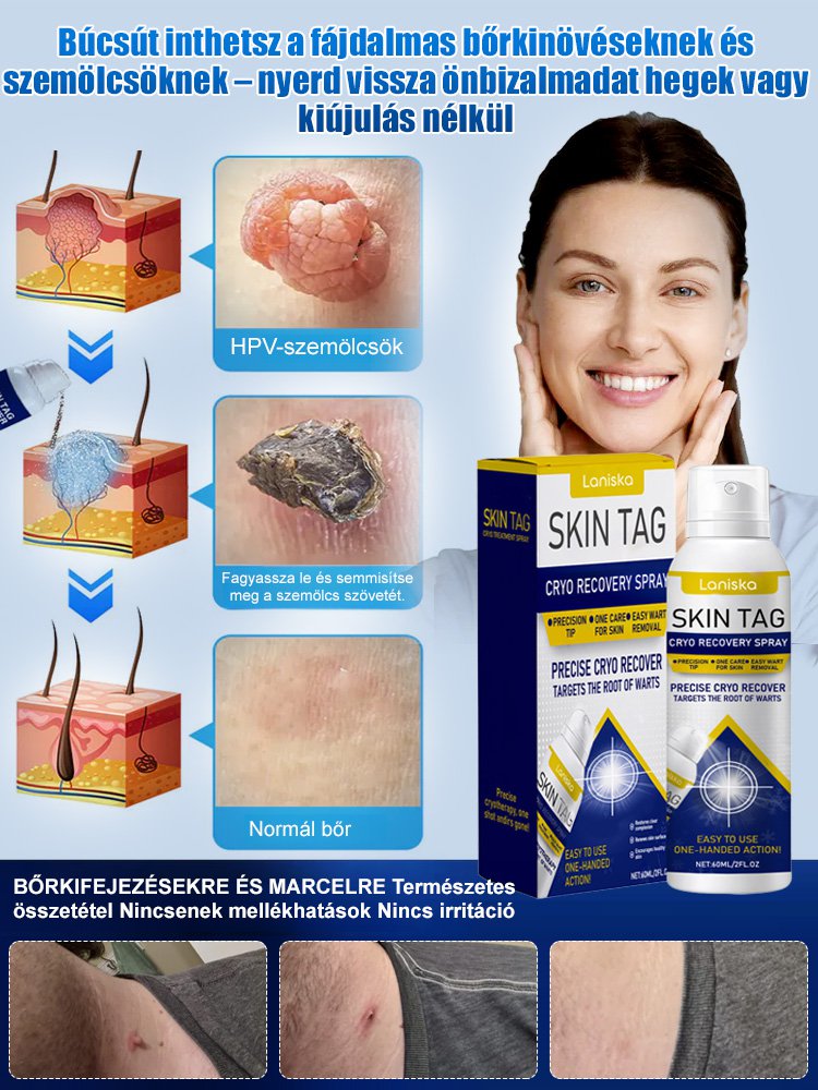 LANISKA szemölcs elleni külső ápoló spray
